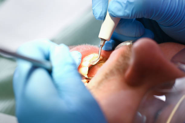 Best Mobile Emergency Dentist in Dana Point, CA
