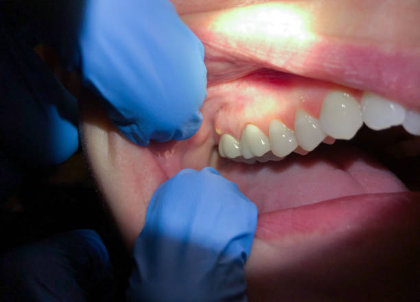Best Pediatric Emergency Dentist in Dana Point, CA
